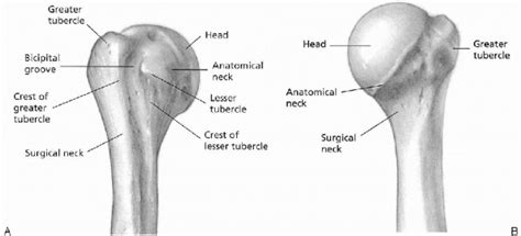 Orif Three Part Fracture Of The Proximal Humerus Teachme Orthopedics