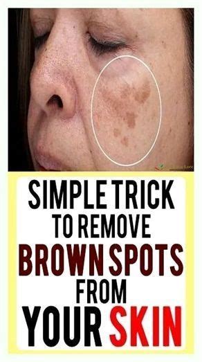Brown Spots On Face Dark Spots Skin Care Acne Anti Aging Skin Care