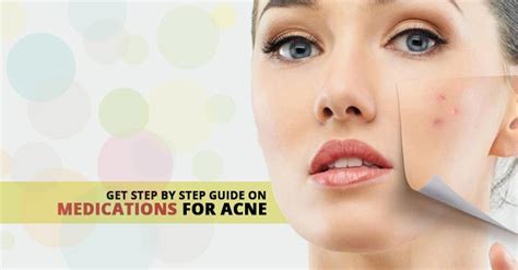 A Basic Guide On Medications For Acne
