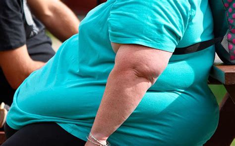 Obesidade M Rbida Considerada Doen A Cr Nica Para Fins De Acessibilidade Semana