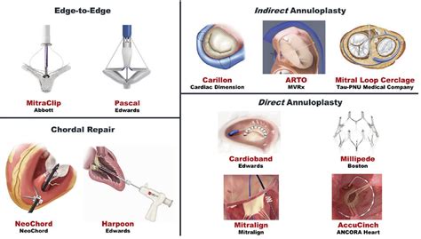 Transcatheter Mitral Valve Repair Devices Download Scientific Diagram