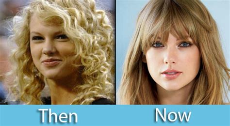 Taylor Swift Nose Job Celebrity Plastic Surgery Taylor Swift