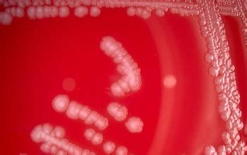 It grows best at temperatures of 30 to 37°c, but it grows well at colder (refrigerator) temperatures in clinical specimens, l. Listeria monocytogenes