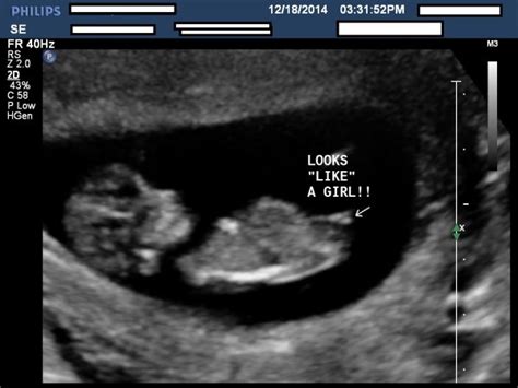 They're around two inches long, and weigh around half an ounce. Comfirmed girl ultrasound pic at 12 weeks - BabyCenter