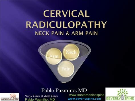 Cervical Radiculopathy Infographic Pain In The Neck
