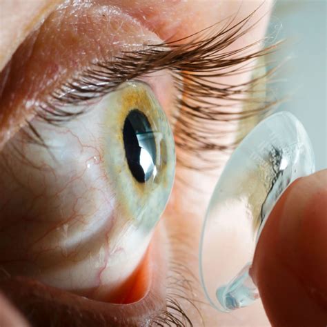 Doctors Discover 28 Year Old Contact Lens In Womans Eye