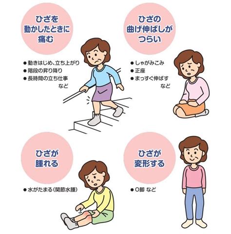 変形性膝関節症｜後藤整形外科医院｜鳥飼の整形外科 ...