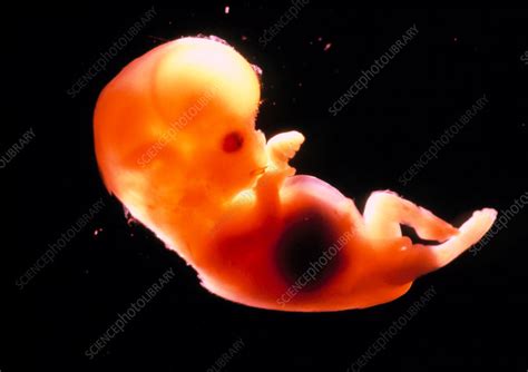 Side View Of A 12 Week Old Foetus Stock Image P6800399 Science