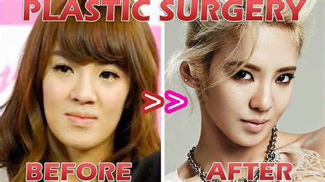 Kpop Plastic Surgery Before And After
