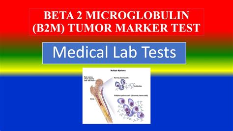 Beta 2 Microglobulin B2m Tumor Marker Test Medical Lab Tests What Is Uses Need