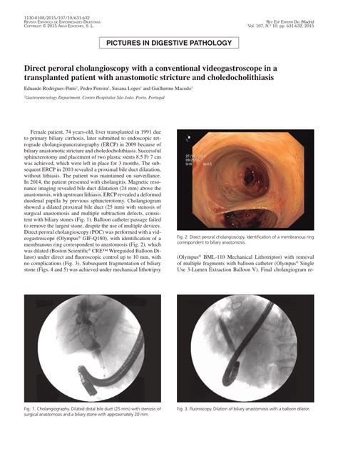 Pdf Direct Peroral Cholangioscopy With A Conventional