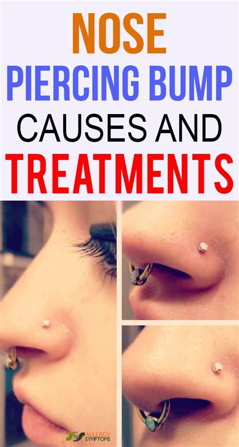 Nose Piercing Bump Causes And Treatments Nose Piercing Bump