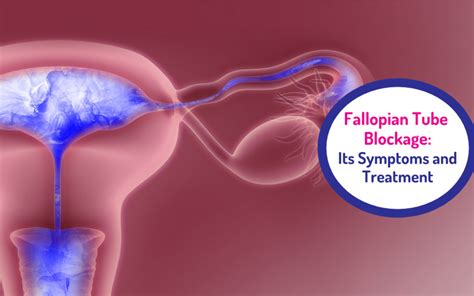 Blocked Fallopian Tubes Symptoms Treatment And Causes Gadget
