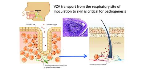 Vzv Tropism For Tonsil T Cells According To The Model Of Vzv Cell