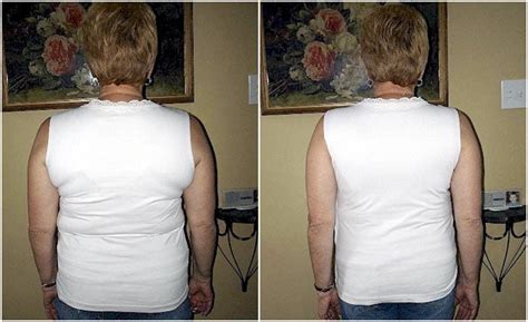 Real Life Transformations In Our No Back Fat Bra Before And After