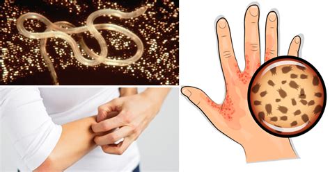 8 Signs Of A Parasitic Infection You Cant Ignore David Avocado Wolfe