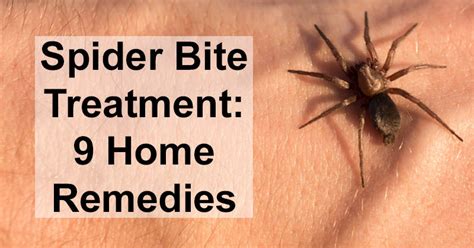 Spider Bite Treatment 9 Home Remedies