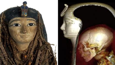 Scientists ‘unwrapped An Ancient Egyptian Mummy Using Digital