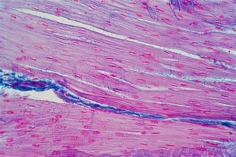Check spelling or type a new query. Histology Of Human Smooth Muscle Under Microscope View For ...