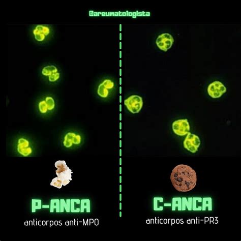 P-anca Reagente O Que Significa