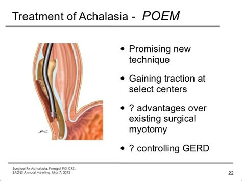 Achalasia Surgery Update 2012
