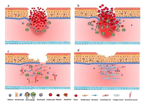 The Process Of Skin Wound Healing A Hemostasis Stage Due To The