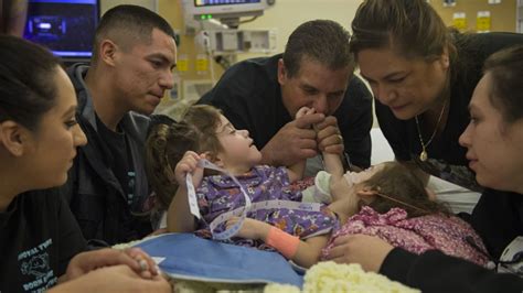 Conjoined Twins Separated In Marathon Surgery The Washington Post