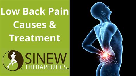 Low Back Pain Causes And Treatment Youtube