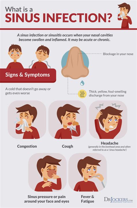 sinus infections causes symptoms and natural support strategies sinusitis sinus infection