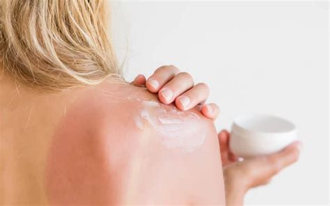 Best Natural Remedies For Sunburn Naturally Made Mom