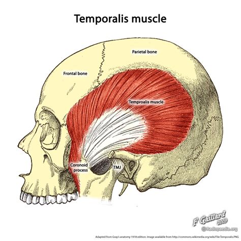 When a muscle contracts, it pulls on the bone, and the bone can move if it is part of a joint. Temporalis muscle (illustration) | Image | Radiopaedia.org