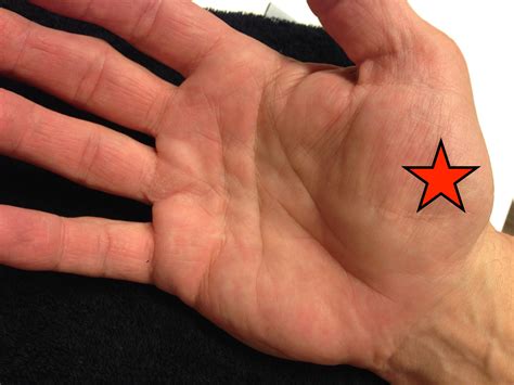 Pijn In De Duim Door Artrose Hand Pols Fysiotherapie En Revalidatie Helpt U Er Graag Van Af