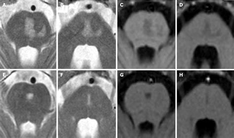 Figure 7 From Magnetic Resonance Imaging Differential Diagnosis Of