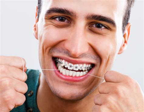 Dental Braces Dubai Best Orthodontist Dubai New Al Shefa