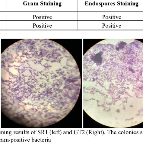 Gram Staining Result Of Selected Bacterial Colonies Download
