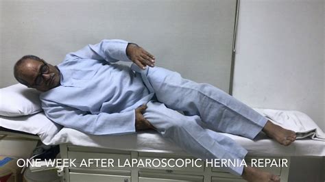 Recovery After Laparoscopic Hernia Repair Youtube