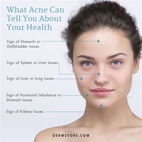 If Youre Suffering From Breakouts The Cause Of Your Acne Could Be