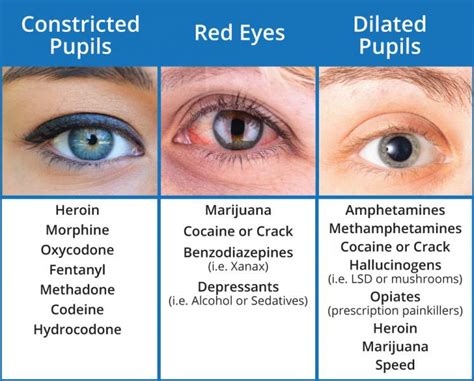 Ochii și Semnele Consumului De Droguri Saptamanaonline