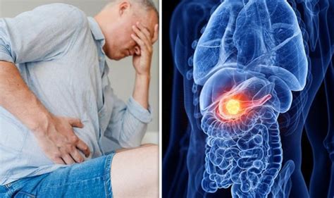 Pancreatic Cancer Dubbed Silent Killer What Are The Early Symptoms