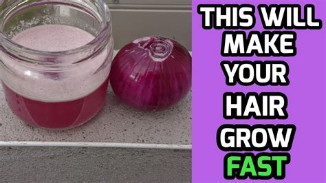 Right Way To Use Onion Juice For Hair Regrowthdandruff Hair Fall