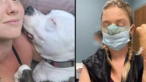 Woman Has Nose Bitten Off By Boyfriends Dog After It Was Startled By