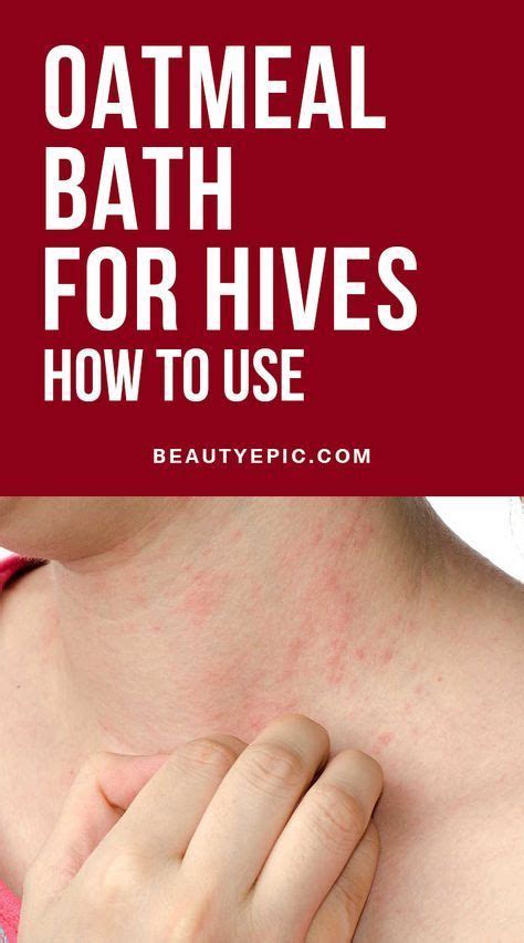 Oatmeal Bath Remedy For Hives How To Use Hives Remedies Allergy