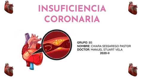 INSUFICIENCIA CORONARIA Cardiología Coronarias uDocz