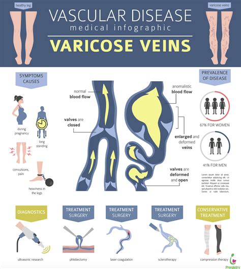 Everything You Need To Know About Varicose Veins In Pregnancy The Pulse