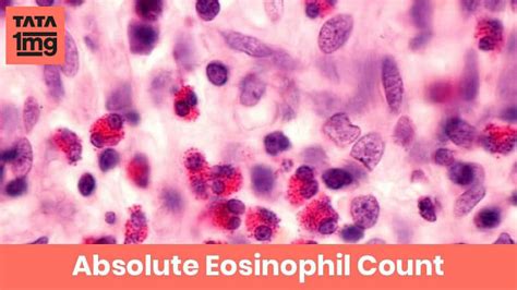 Absolute Eosinophil Count Aec Purpose And Normal Range Of Results 1mg