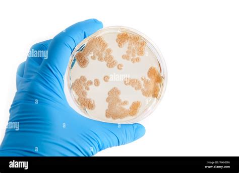 Fungi Grow On Agar Plate In Laboratory Stock Photo Alamy