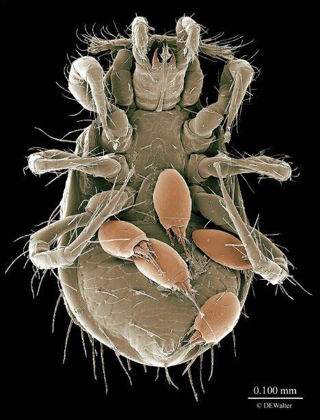 37 Best Dust Mites Images On Pinterest Dust Mites Bugs And Strange