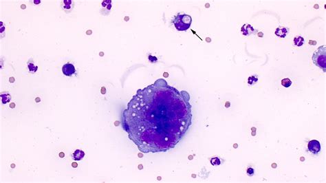 Images Tagged Macrophage Eclinpath