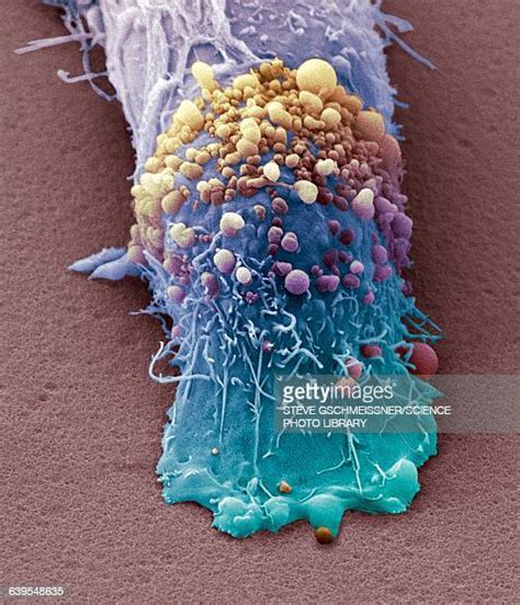 Skin Cancer Tumor Photos And Premium High Res Pictures Getty Images