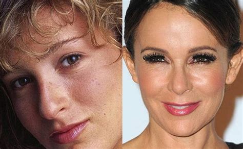 Jennifer Greys Before And After Plastic Surgery Effect On Her Stardom